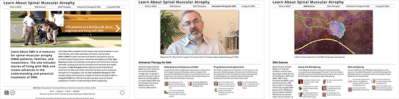 Learn About Spinal Muscular Atrophy